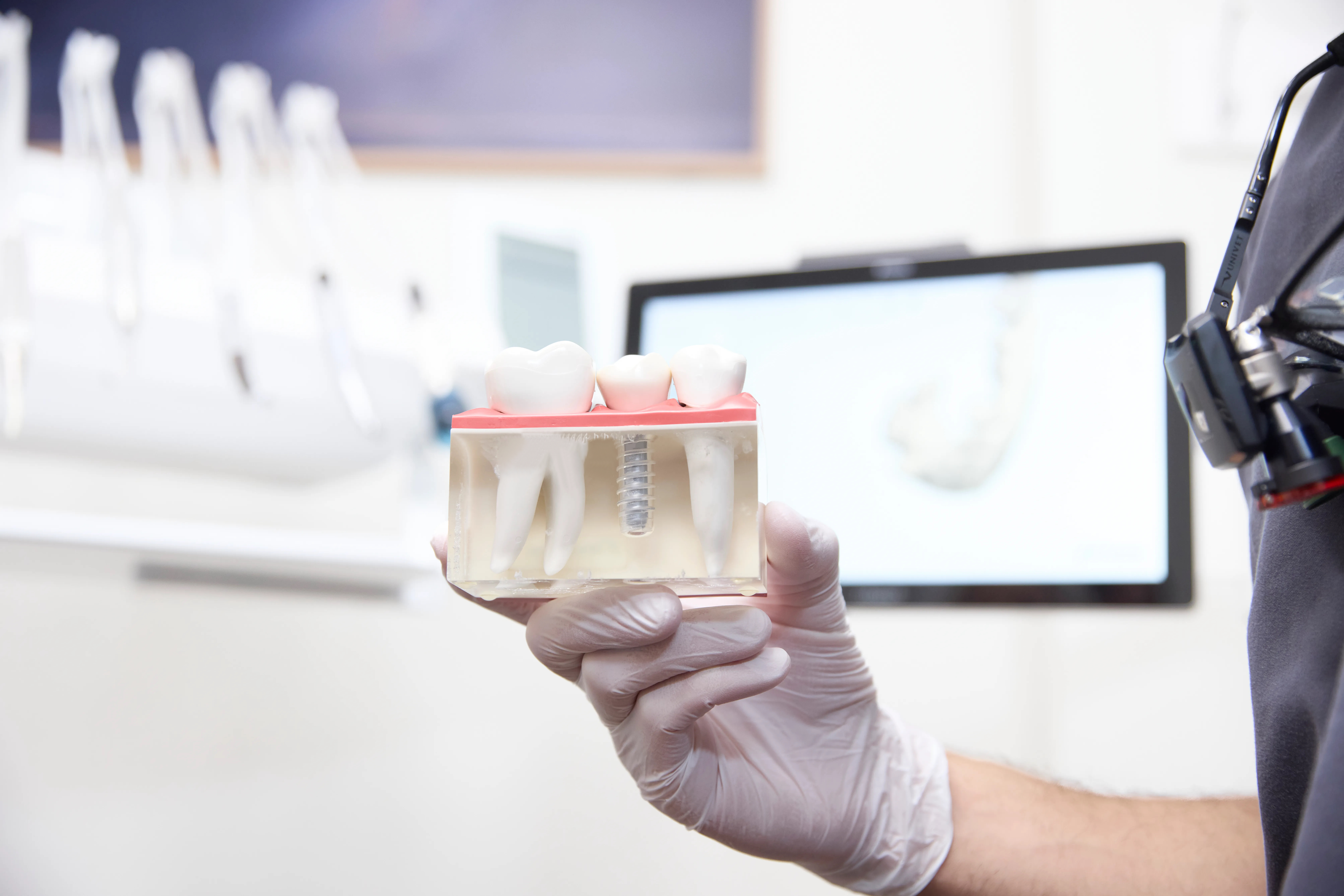 Tandimplantat - Mariatorgets tandläkarmottagning